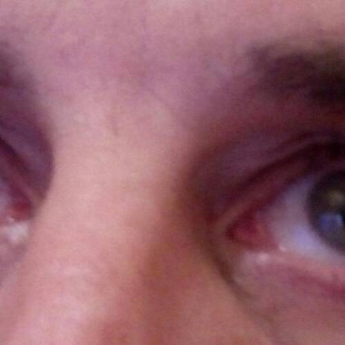 Foto extra 1