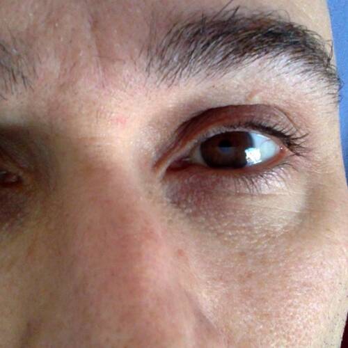Foto extra 1