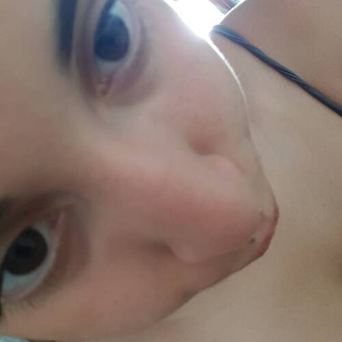 Foto extra 2