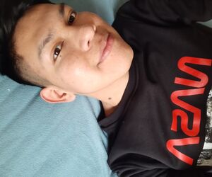 Axelnoza